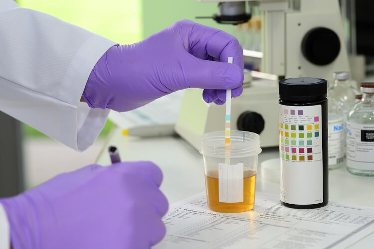 A lab tech tests a urine sample